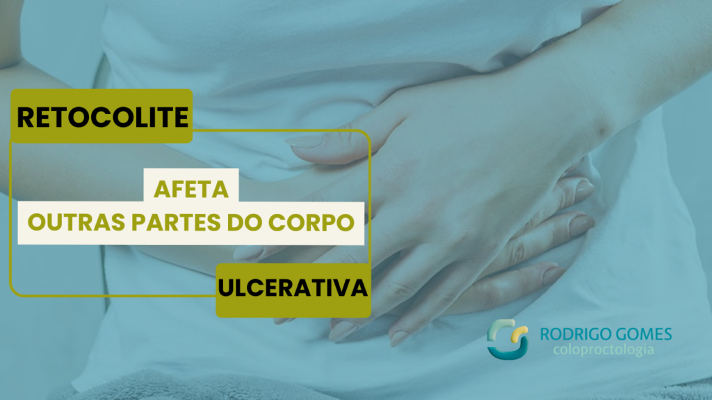 Retocolite ulcerativa pode afetar outras partes do corpo