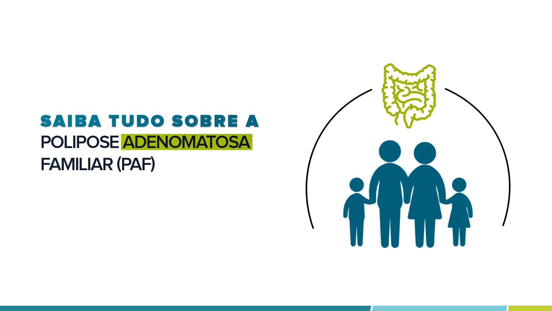 Saiba tudo sobre a Polipose Adenomatosa Familiar (PAF)