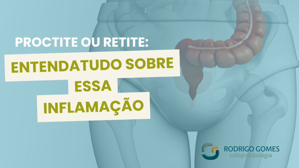 Proctite ou Retite entenda tudo sobre essa inflamação