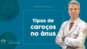 Tipos de caroços no ânus - Dr. Rodrigo Gomes