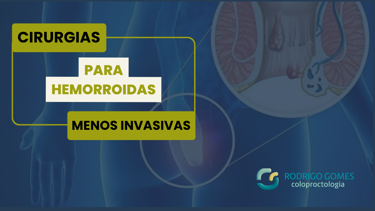 Cirurgias menos invasivas para hemorroidas