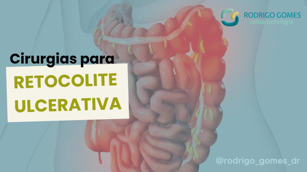 Cirurgias para Retocolite Ulcerativa