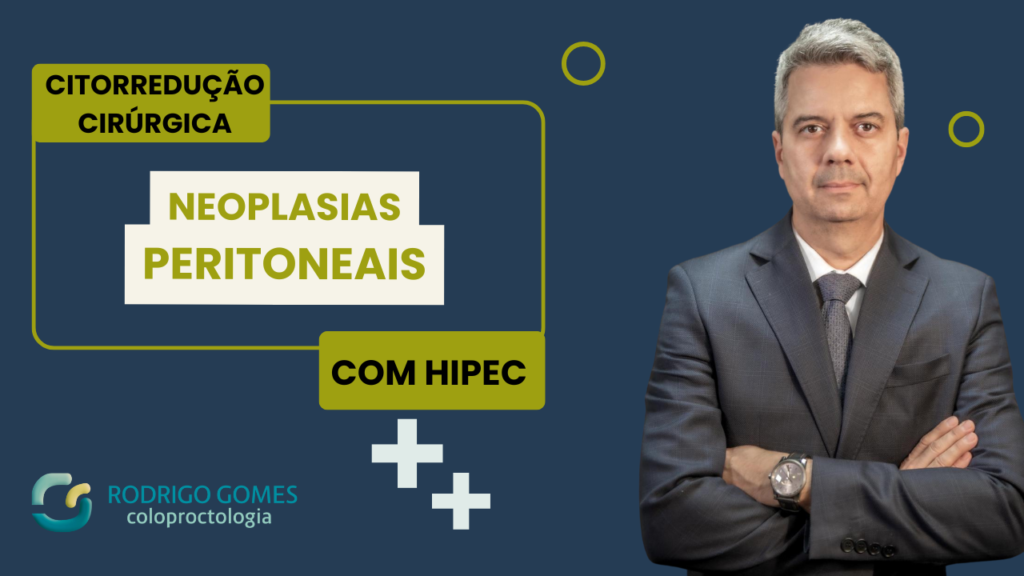 Citorredução Cirúrgica com HIPEC Avanços no Tratamento de Neoplasias Peritoneais