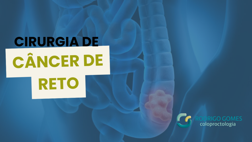 Cirurgia de câncer de reto: Quem precisa operar e quem pode fazer tratamento não operatório?