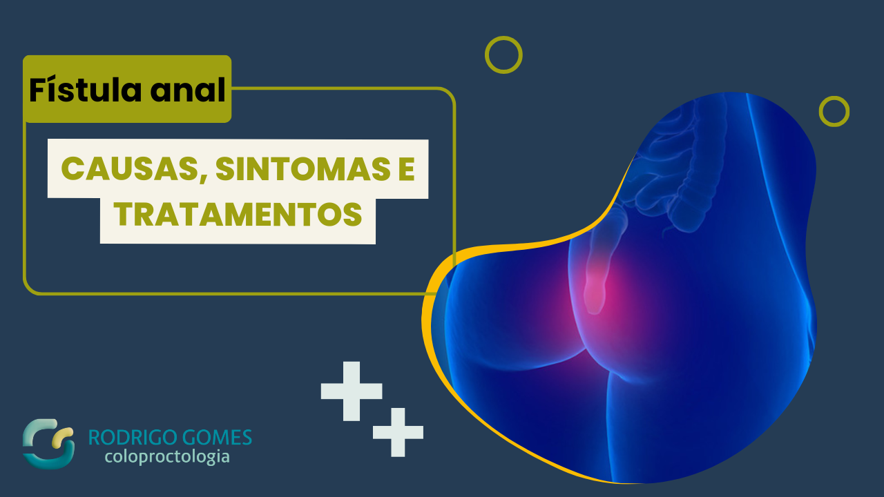 Fístula anal causas, sintomas e tratamentos