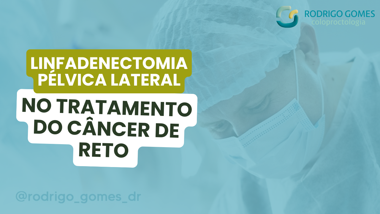 Linfadenectomia Pélvica Lateral Um Avanço no Tratamento do Câncer de Reto