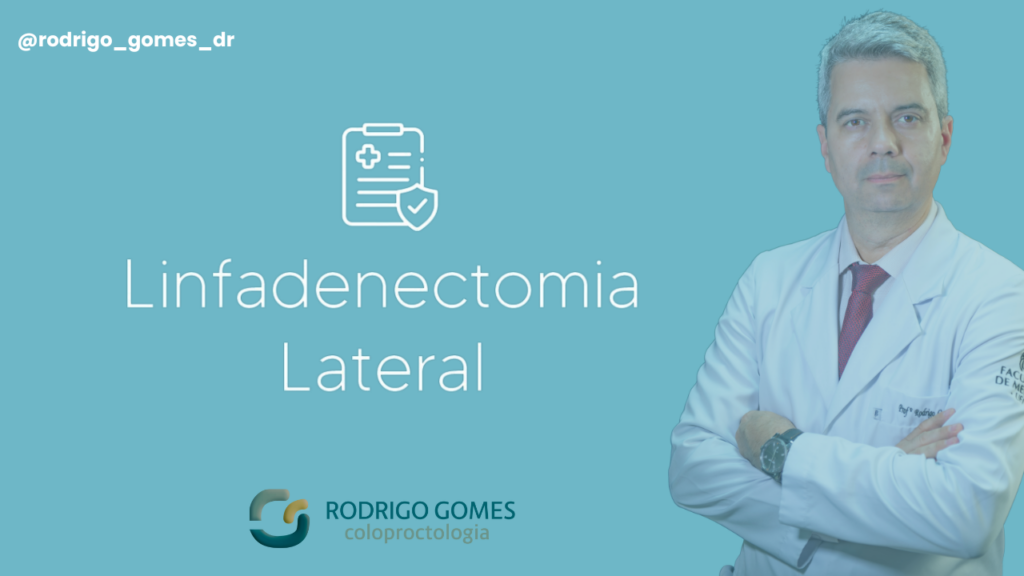 Linfadenectomia Lateral Quando é Necessária e Quais os Benefícios