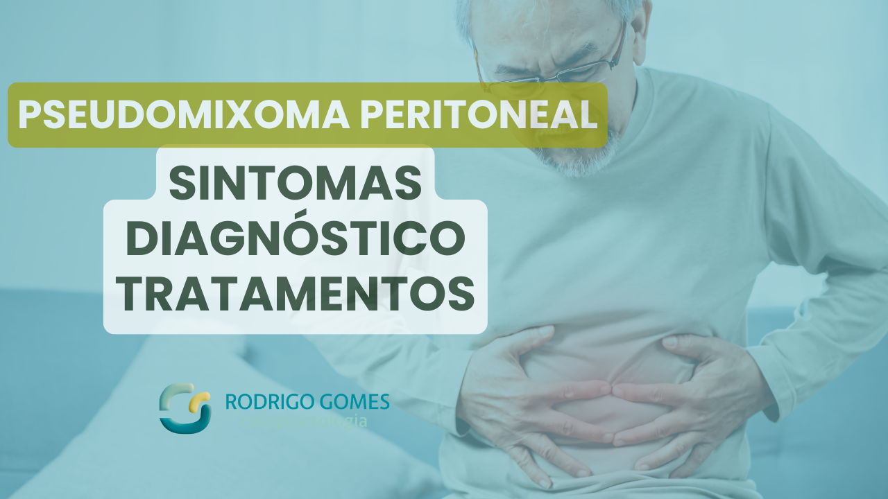 Já ouviu falar em pseudomixoma peritoneal? Saiba como identificar essa condição rara