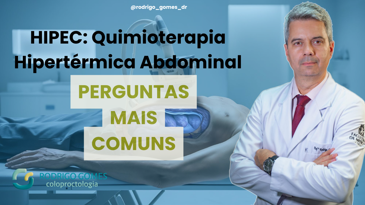 HIPEC: perguntas comuns que recebo no consultório sobre a quimioterapia hipertérmica