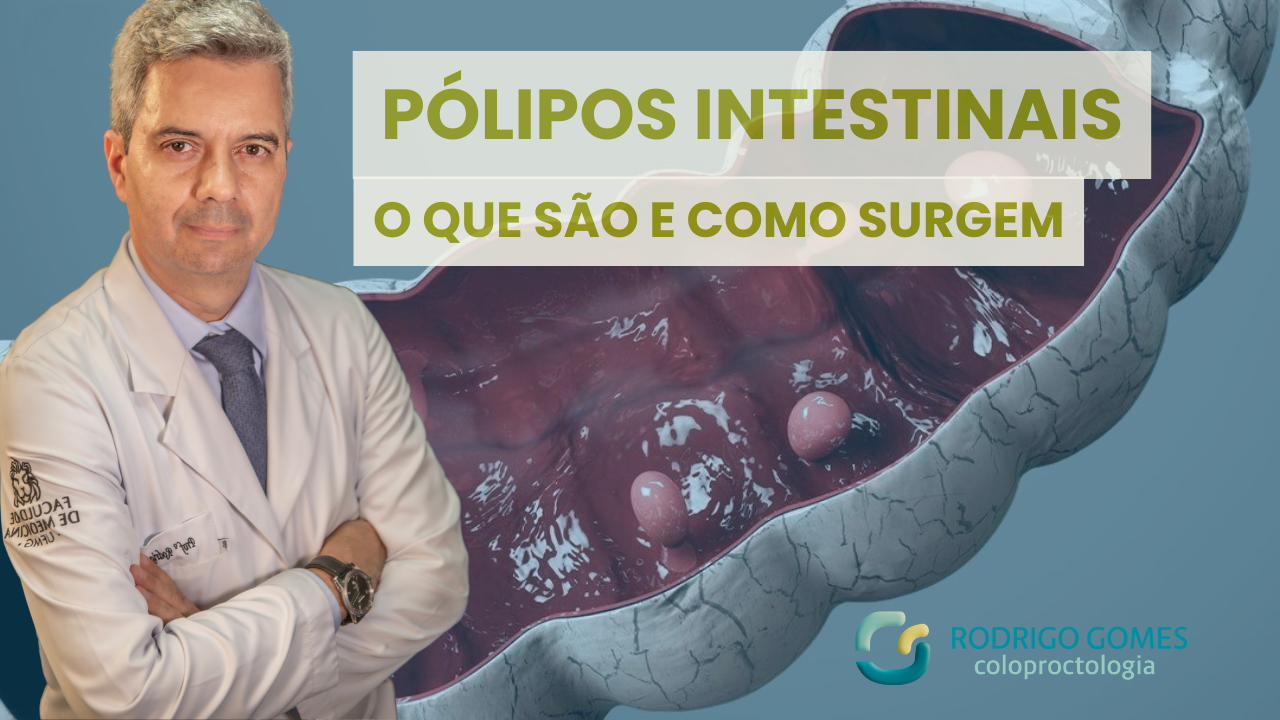 Pólipos intestinais: o que são, como surgem e por que devem ser removidos
