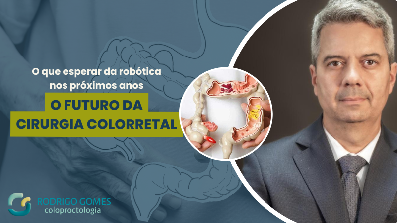 O que esperar da robótica nos próximos anos O futuro da cirurgia colorretal