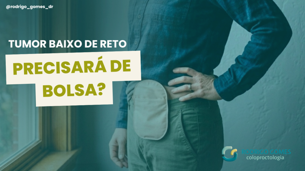 Tumores baixos: o que define se o paciente precisará de bolsa?
