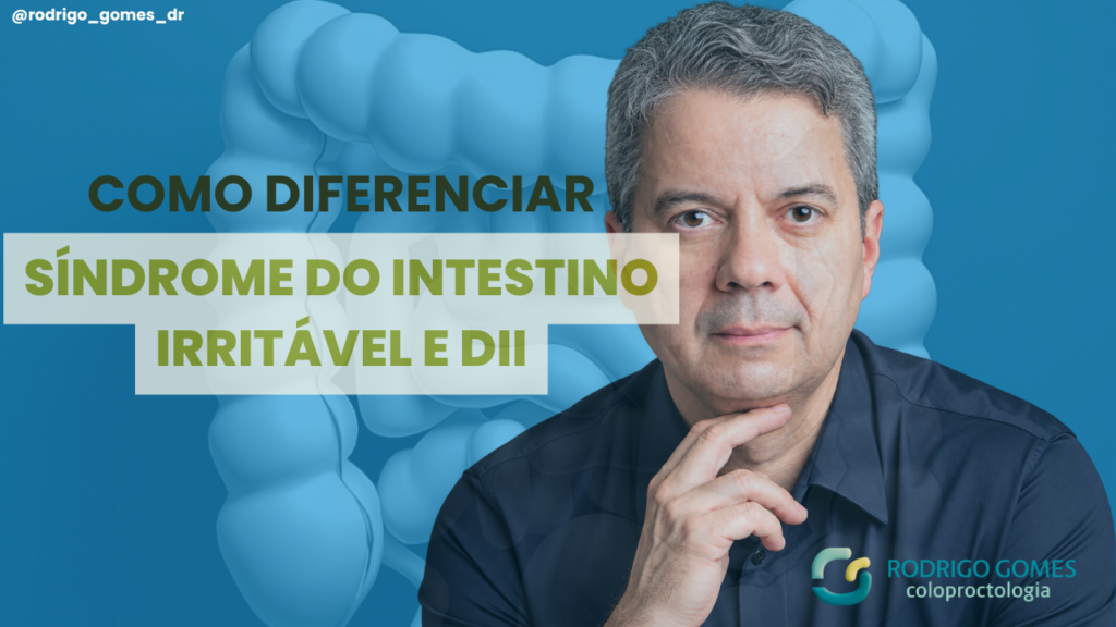 Como diferenciar a Síndrome do Intestino Irritável das Doenças Inflamatórias Intestinais