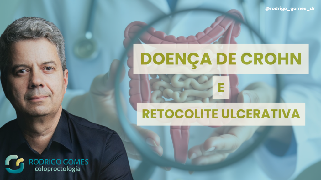 Doença de Crohn e Retocolite Ulcerativa: por que a cirurgia tem papéis tão diferentes?